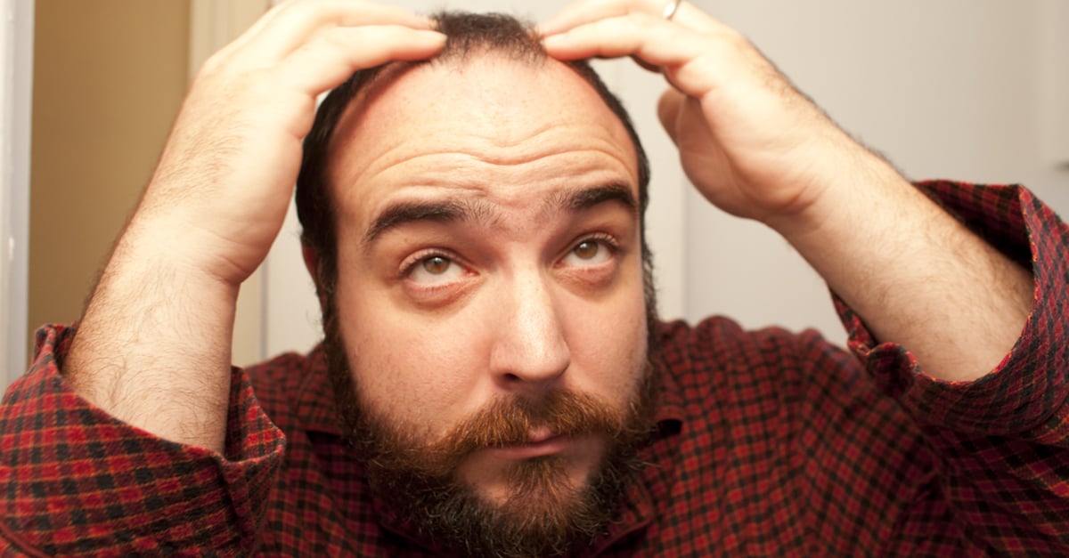 Researchers Say Mcdonald S Fries Can Cure Baldness 22 Words