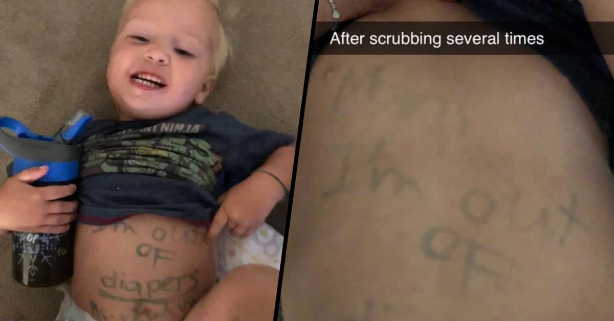 Daycare Writes a Note on Baby’s Stomach to Shame His Mom Into Packing More Diapers