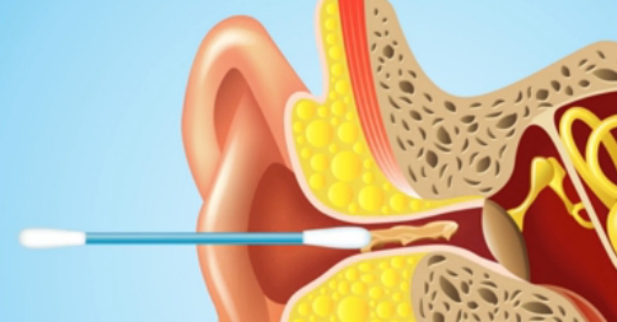 This Is Why You Should NEVER Put QTips In Your Ears 22 Words