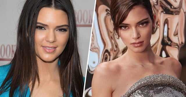 Shocking Side By Sides Of Celebrities Before And After Surgery Are Blowing People S Minds 22 Words Randy had reached 350 pounds in 2001 and after going through with weight loss surgery, he is now healthier and happier. celebrities before and after surgery