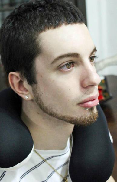 Man Undergoes Extreme Surgery To Look Like Whimsical