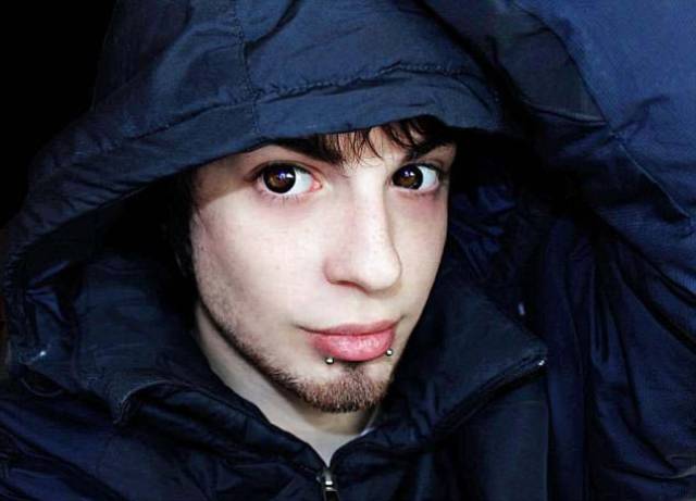 Man Undergoes Extreme Surgery To Look Like Whimsical
