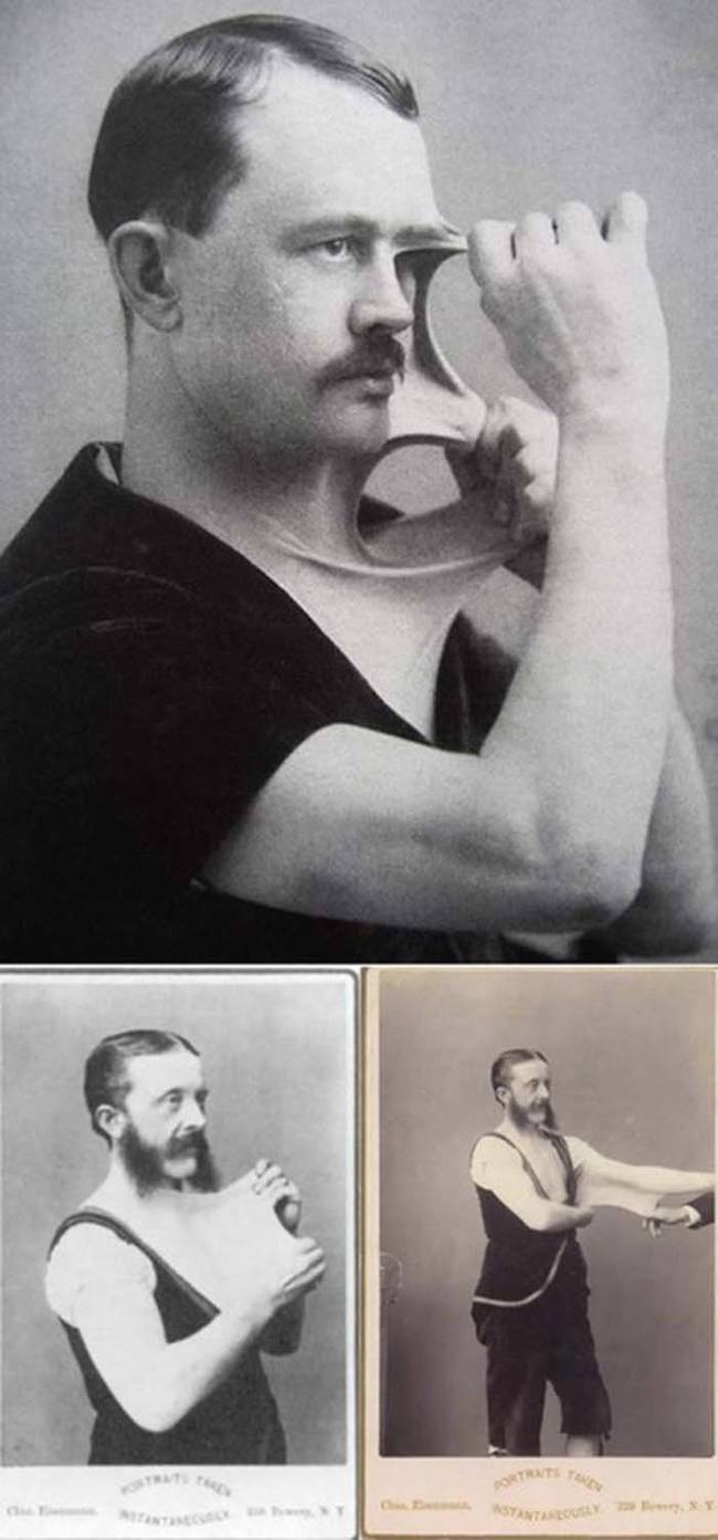 Manusia elastis